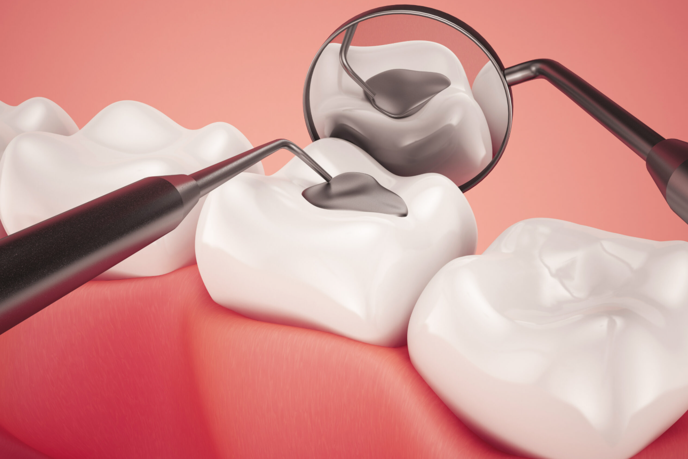 Serenity Health Tooth filling